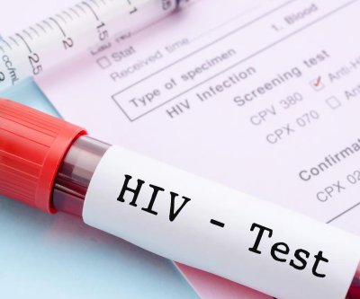 German patient is 7th person seemingly cured of HIV