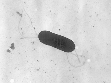Two deaths linked to listeria food poisoning from meat sliced at deli counters