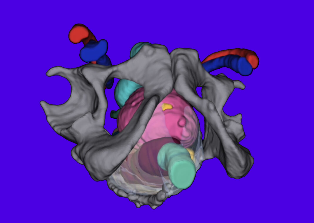 Intermountain Health First to Use New 3D Technology for Patients Undergoing Complex Cancer Surgery